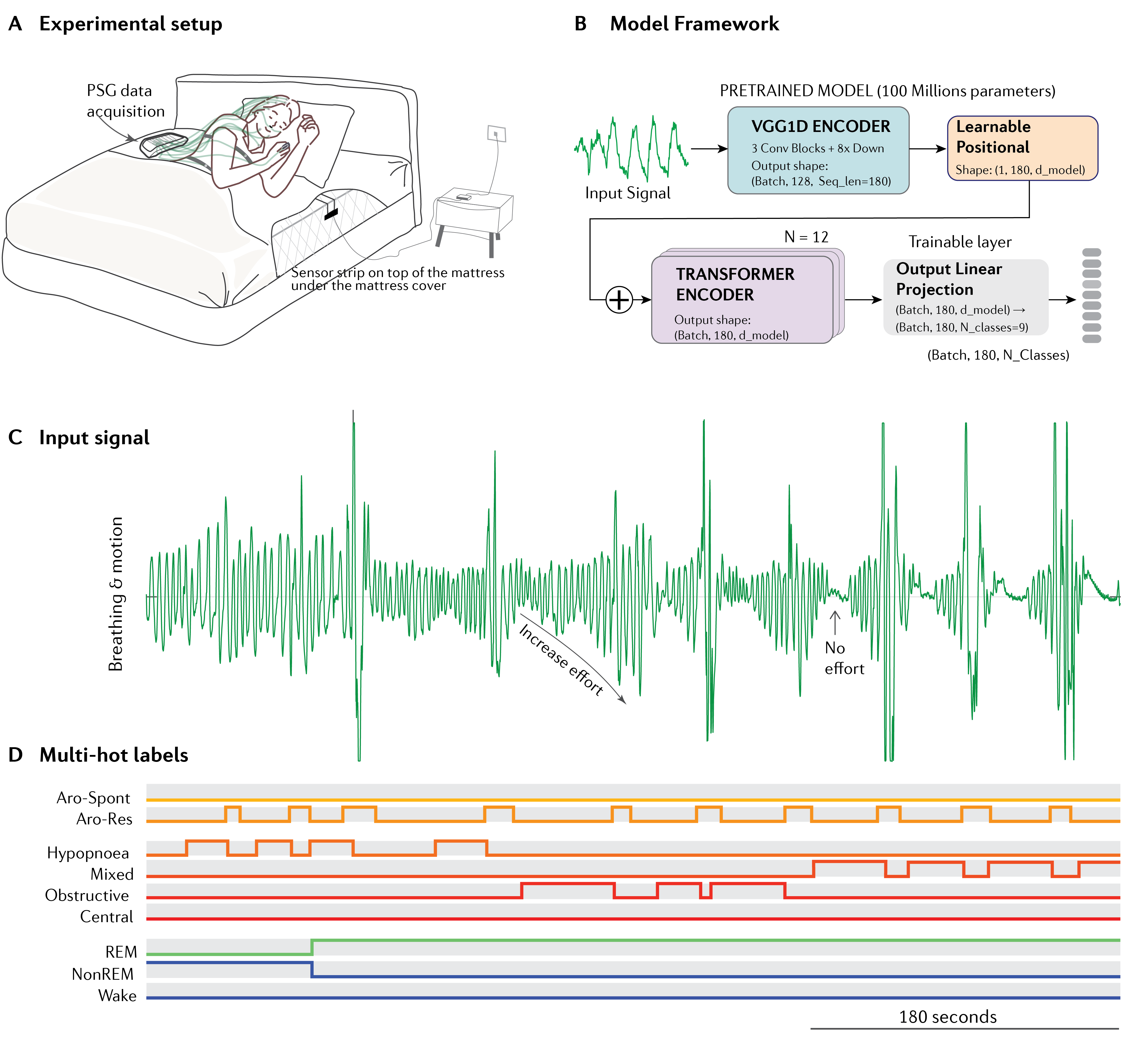 MedBug research workflow showing bedside sensor setup, VGG1D and Transformer model architecture, input breathing signal and multi-label overnight outputs